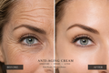 Anti-aging 4
