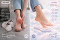 Before After Cloud Feet