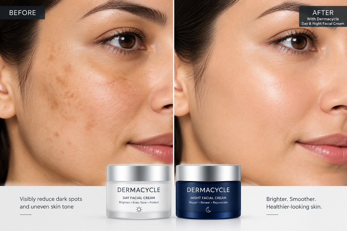 Before After Dark Spots