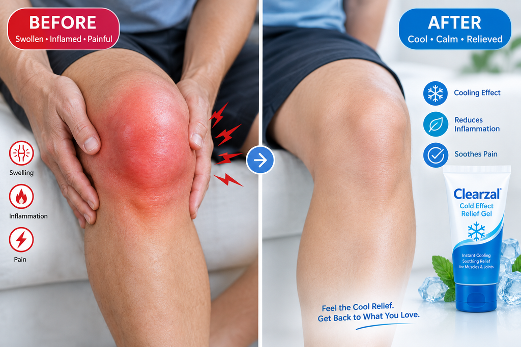 Before After Knee