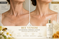 Before After Neck