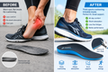 Before After Running Insole
